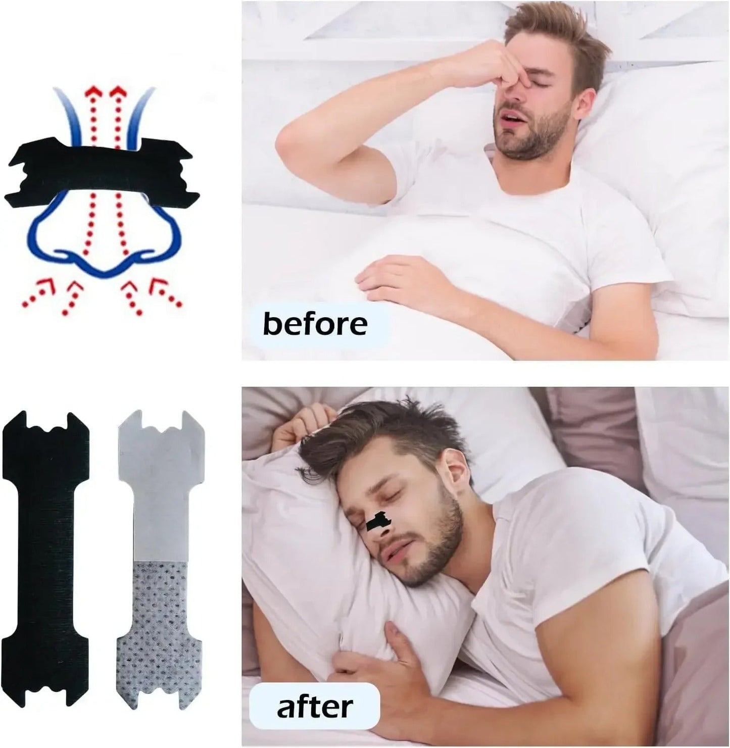 The Nasal Strips