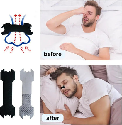 The Nasal Strips